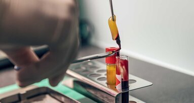 Weltweit erste Leitlinie: Platelet-Rich-Fibrin in der Implantologie