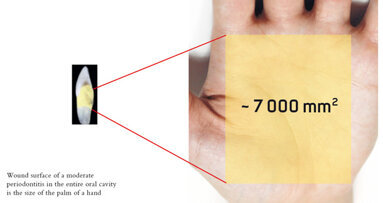 Air-Flow kills biofilm