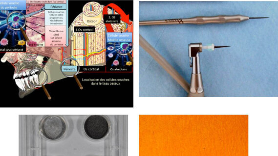 « Pushing back the limits » : Repousser les limites du possible