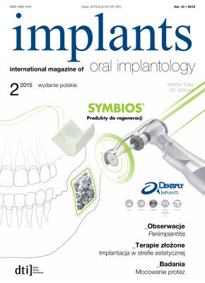 implants Poland No. 2, 2015 implants Poland No. 2, 2015