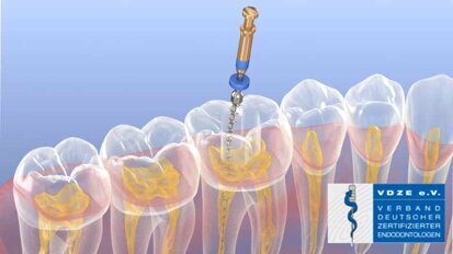 Aufruf zur Falleinreichung für den Endo-Award 2022