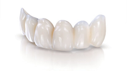 Rethinking provisionals: The many advantages of premade custom temporaries Rethinking provisionals: The many advantages of premade custom temporaries