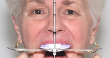 Digitální technika přenosu obličejovým obloukem pomocí dentofaciálního analyzátoru