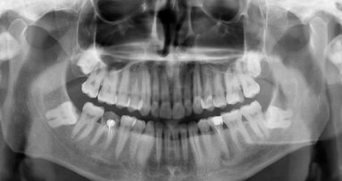 On the pulse of endodontics—the key role of new technologies in root canal therapy