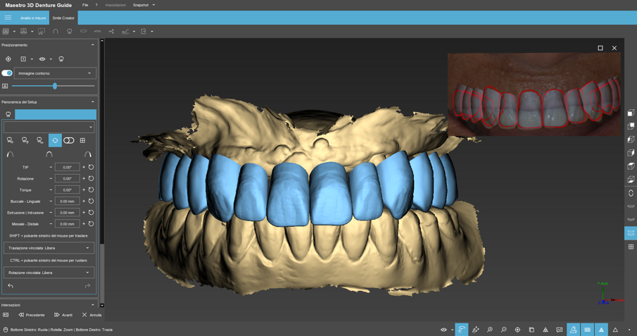Fig. 14 - Il montaggio dei denti corrisponde alle linee di contorno dei denti fotografici del progetto 2D.