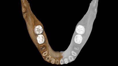 Mandible helps to uncover history of civilisations in Tibet Mandible helps to uncover history of civilisations in Tibet