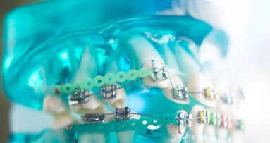 Kunstmatige intelligentie stroomlijnt orthodontie