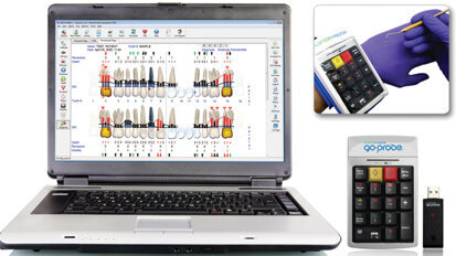 Florida Probe releases new periodontal charting system