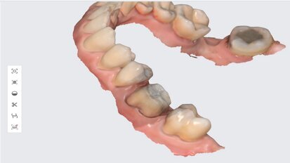 3D tisk ve stomatologii: Tajemství, jak nabídnout více za méně