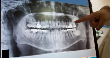 Τρόποι με τους οποίους η ψηφιακή ακτινογραφία θα βελτιώσει την καθημερινή κλινική πράξη