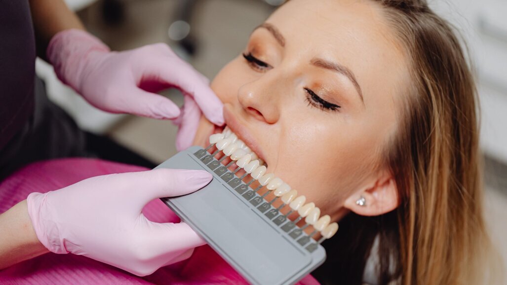 Digital tools to improve shade selection