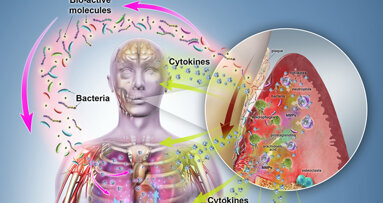 Zánět tkání parodontu – zjednodušeně