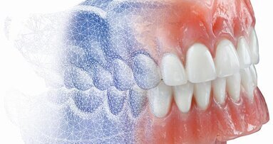 AvaDent heeft met digitale prothese de toekomst