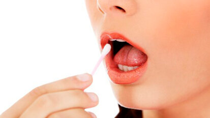 La presenza in bocca di alcuni batteri potrebbe essere indice di un maggior rischio di sviluppo del cancro del pancreas