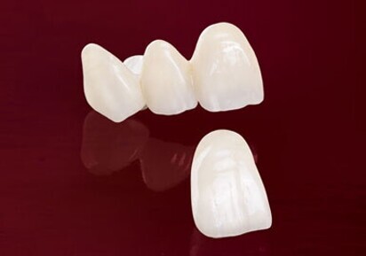 BruxZir® Anterior Solid Zirconia