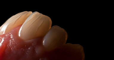 Photographie dentaire numérique