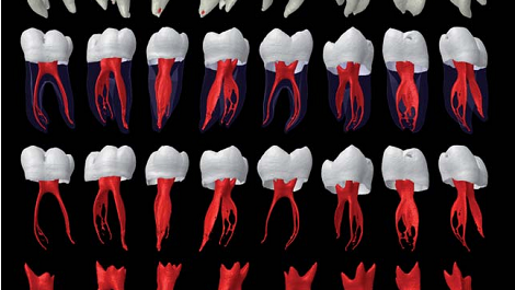 Giải phẫu ống tuỷ chân của răng hàm lớn thứ nhất hàm dưới - những ý nghĩa và khuyến cáo lâm sàng