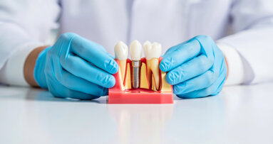 Dentsply Sirona announces new webinars on implant dentistry