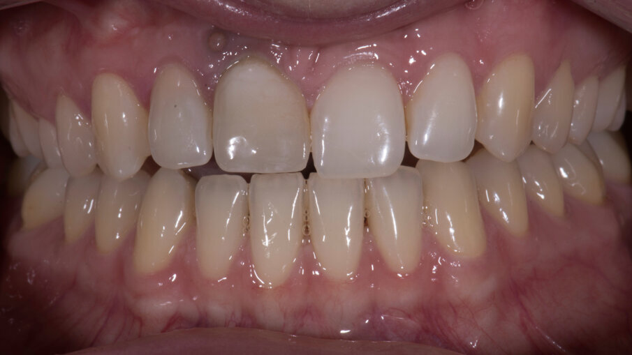 Figg. 2-4_Immagini iniziali.