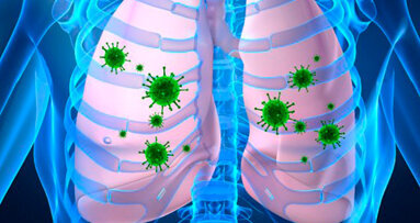 Allarme degli odontoiatri irlandesi sui rischi derivanti da infezioni della bocca