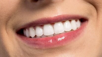 Meer duidelijkheid over cosmetische mondzorg