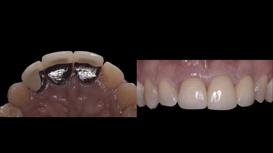 Fig. 2_Situazione iniziale del paziente. 