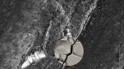 New method could prevent failure of dental implants