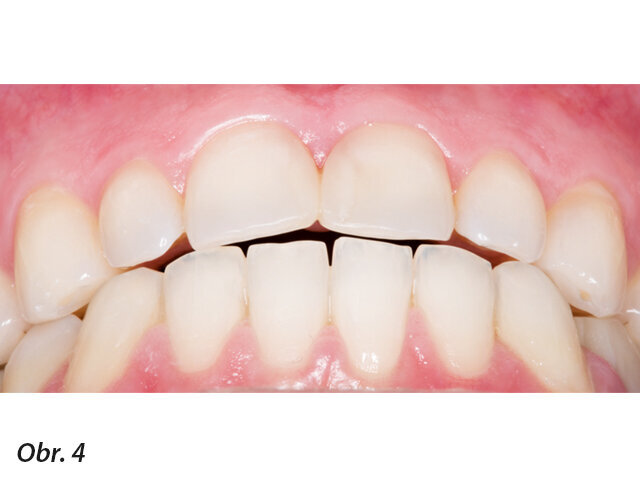 Počáteční klinická situace