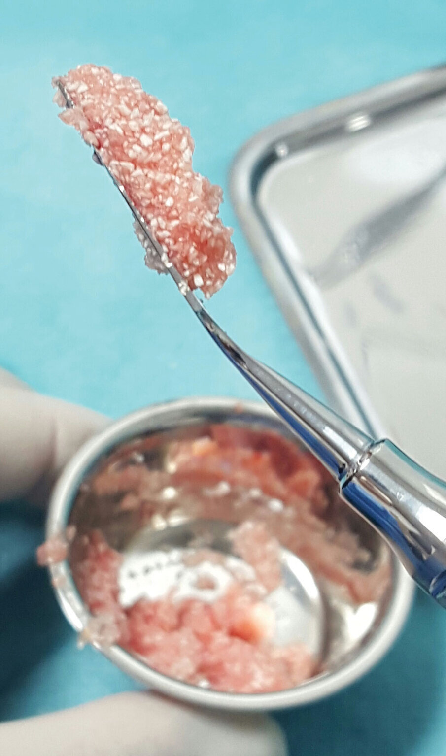 Fig. 5: PRF sticky bone.