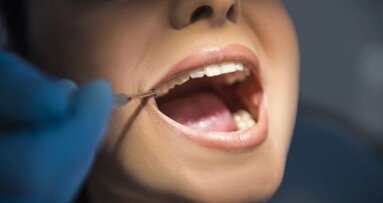 73% van de patiënten liegt tegen tandarts