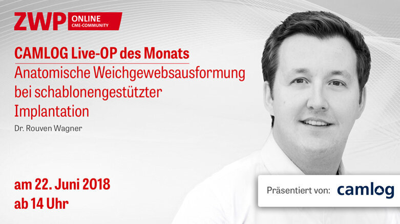 CAMLOG Live-OP am 22. Juni ab 14.00 Uhr