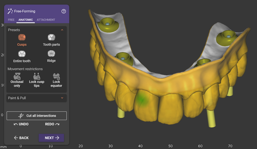 Fig. 8: Free-forming the suprastructure.