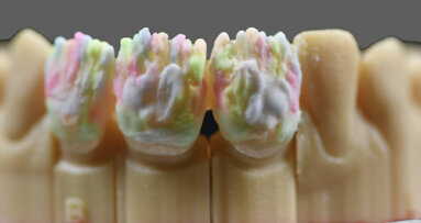 Personal Oral Protocol – L'approche des nouveaux outils de communications entre le cabinet dentaire et le laboratoire