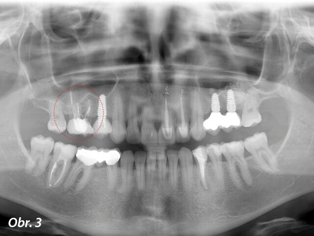 Radiografické vyšetření