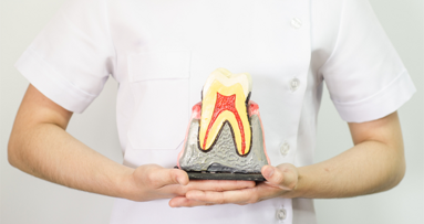 Wurzelkanalbehandlung oder doch ein Implantat?