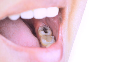 Beyond the clinic: FDI congress sessions place oral health in a wider policy context