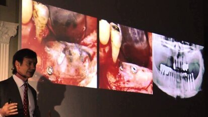 „Kierunki dla implantologii i inżynierii tkankowej” – 12. Kongres OSIS