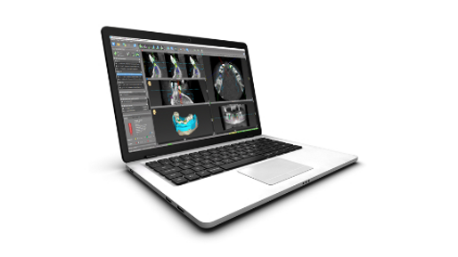 Straumann coDiagnostiX