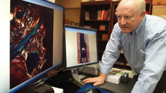 Bone-regenerating protein could improve dental implant success