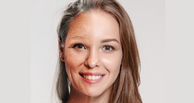 ¿Se puede revertir el envejecimiento? (1)