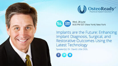 Webinar to discuss latest technology in implantology