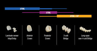 Zirconia multistrato in diversi livelli di traslucenza