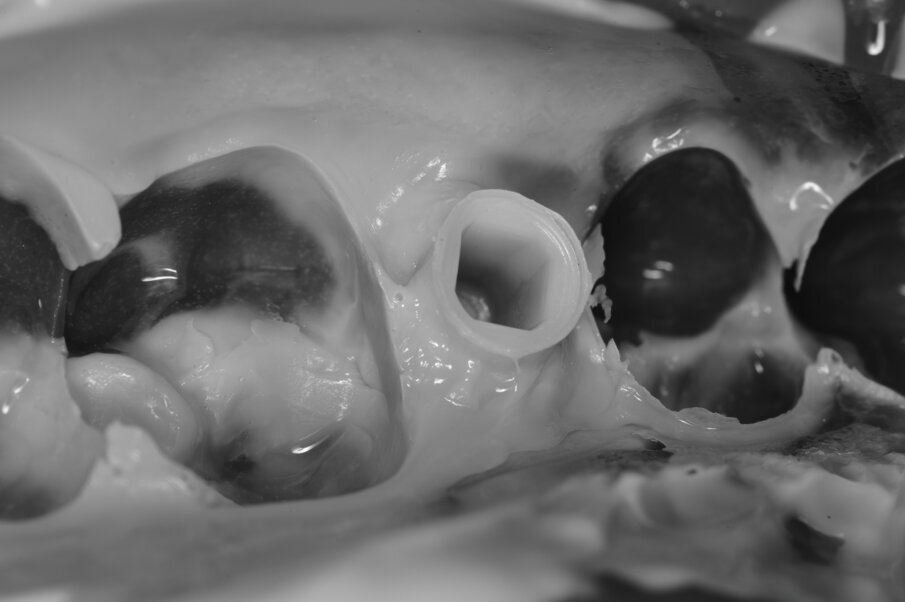 Fig. 9_Dopo aver estratto il cucchiaio d’impronta si deve valutare oltre alla qualità del dettaglio trasferito e la stabilità del transfer.