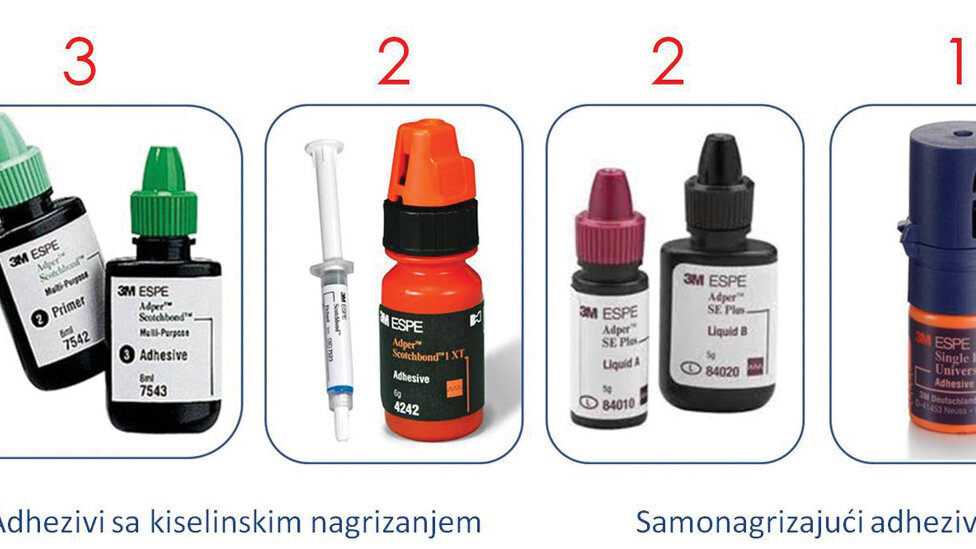 Dentalni adhezivni sistemi – klasifikacija, protokoli primene i interacija sa zubnim tkivima