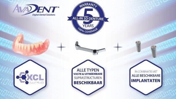 Vijf jaar all-in garantie overtreft origineel-op-origineel