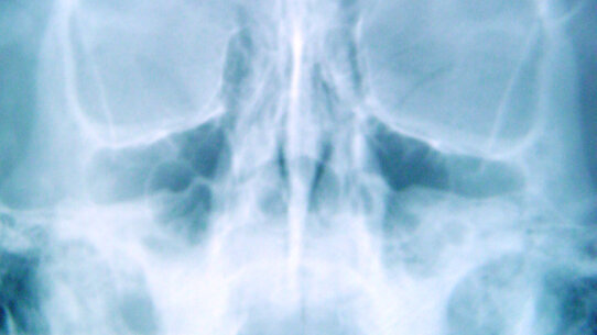 CBCT: maggiore sicurezza per la radiologia orale