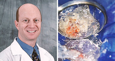 Interview: “Bioactive endodontics is the future”