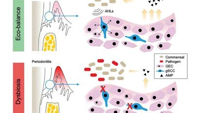 Identificirali so celice v dlesni, ki ščitijo pred parodontalno boleznijo