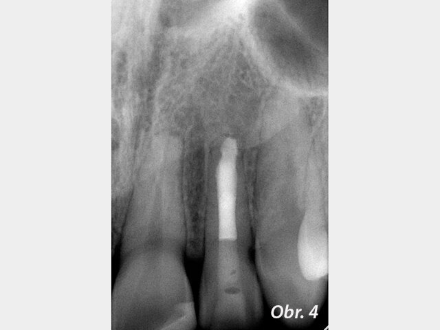 Obr. 4: červen 2018 – tzn. po 10 letech
