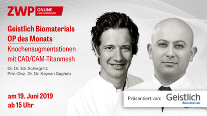 OP zur Knochenaugmentation mit CAD/CAM-Titanmesh OP zur Knochenaugmentation mit CAD/CAM-Titanmesh